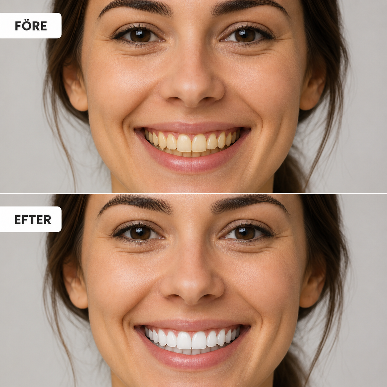 SmileyTeeth - Neutraliserar & dödar gula toner
